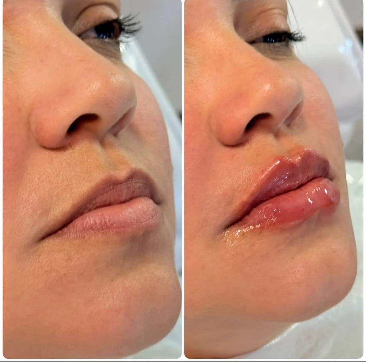 Estética - Maringá - Paraná - Estética Jana.Lace – foto 1