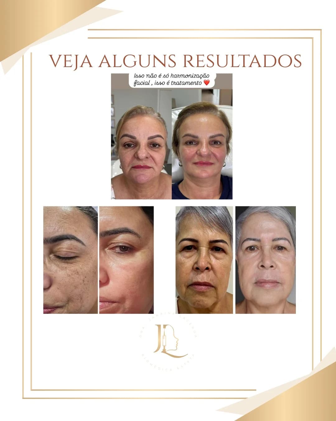 Estética - Maringá - Paraná - Estética Jana.Lace – foto 2