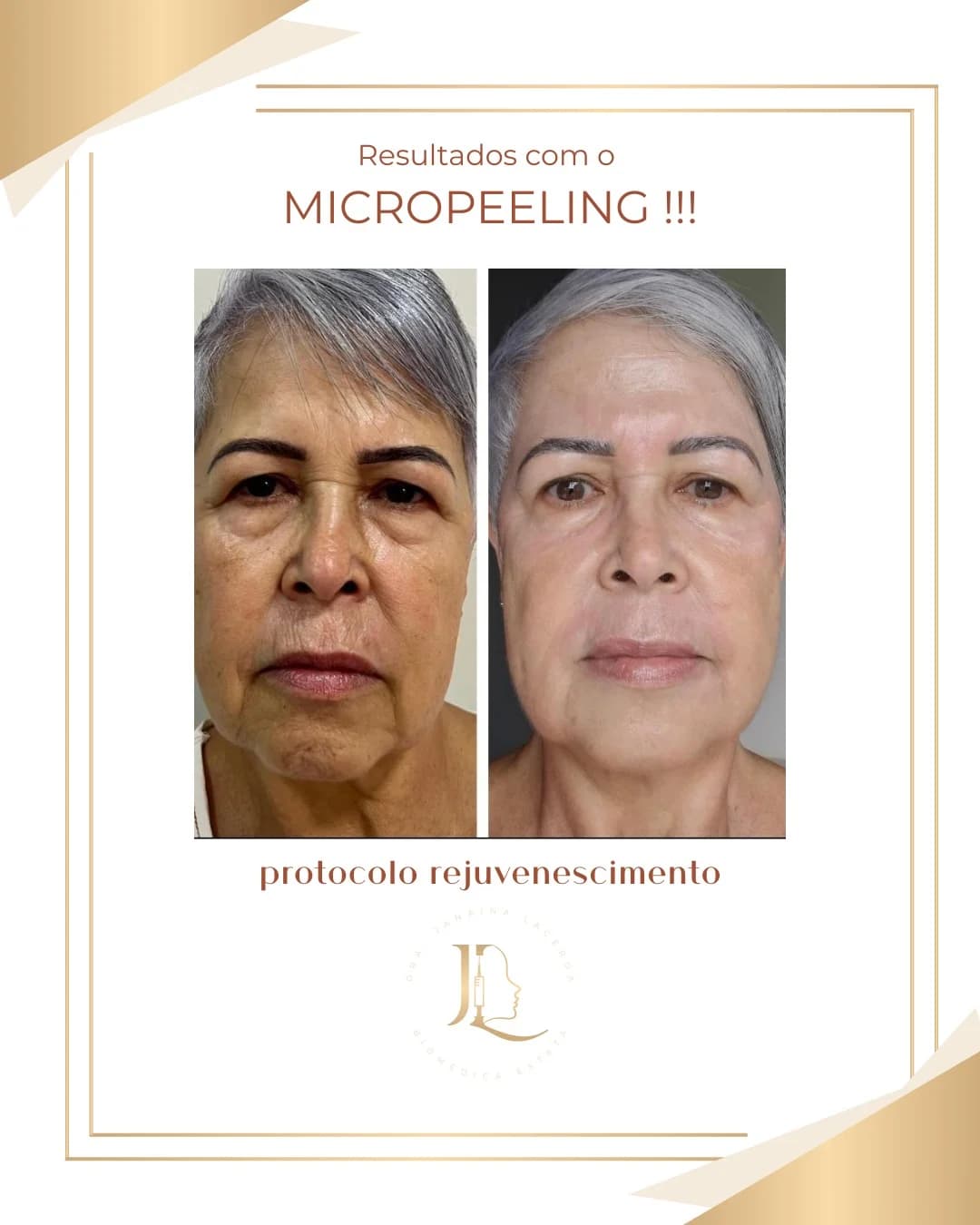 Estética - Maringá - Paraná - Estética Jana.Lace – foto 3