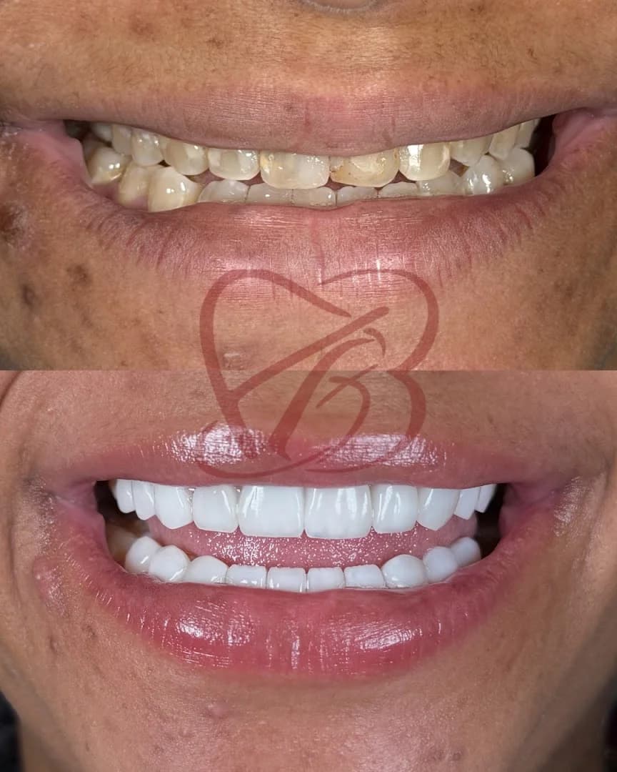 Bruna Silveira - Odontologia Especializada – foto 1