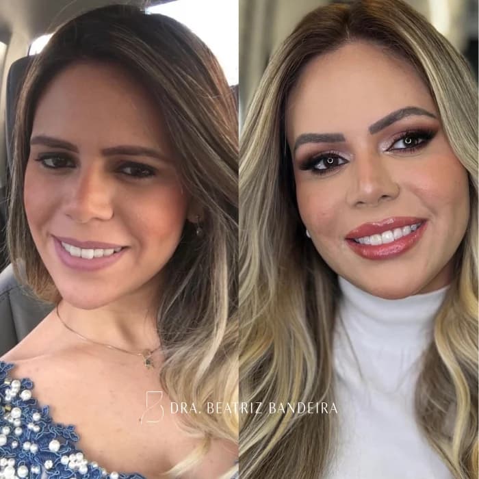 Dra. Beatriz Bandeira | Harmonização Facial em Fortaleza