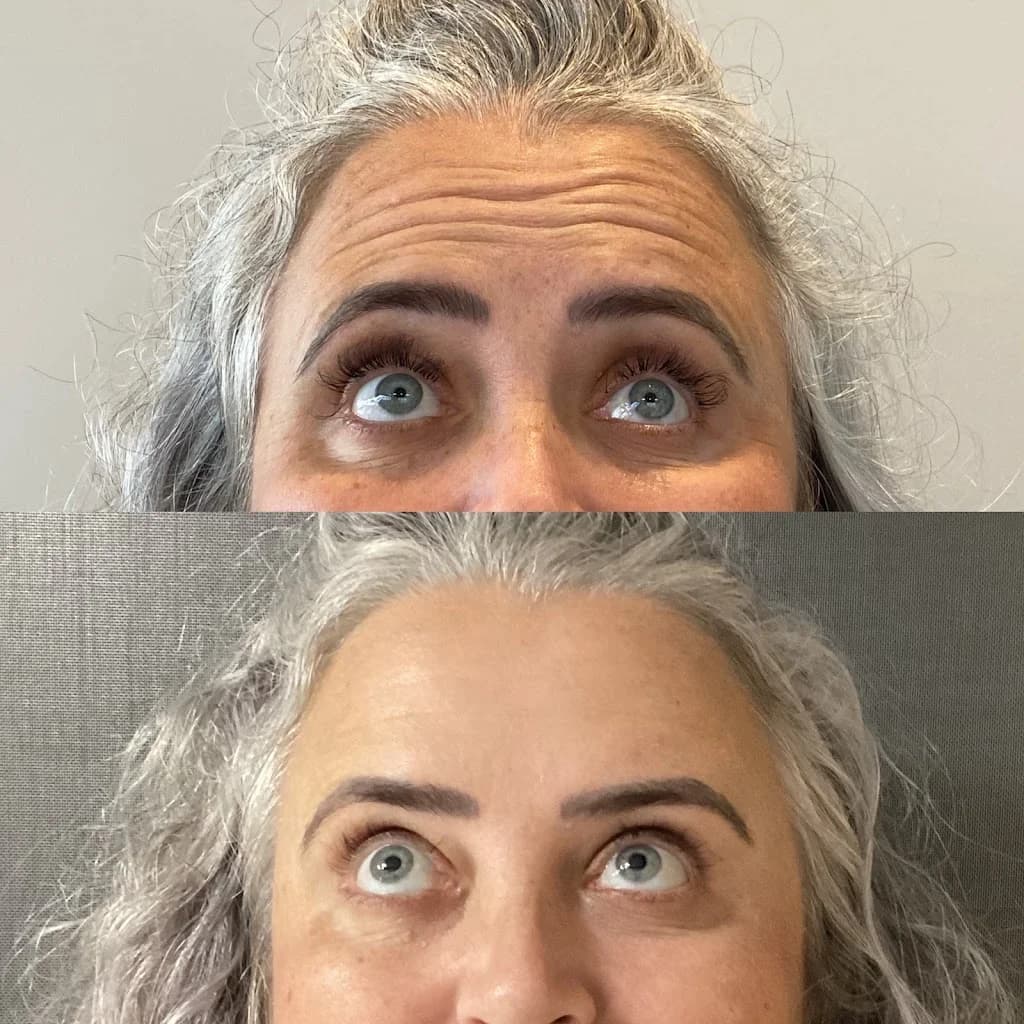 Dra. Geise Vargas | Harmonização Facial em São Leopoldo – foto 3