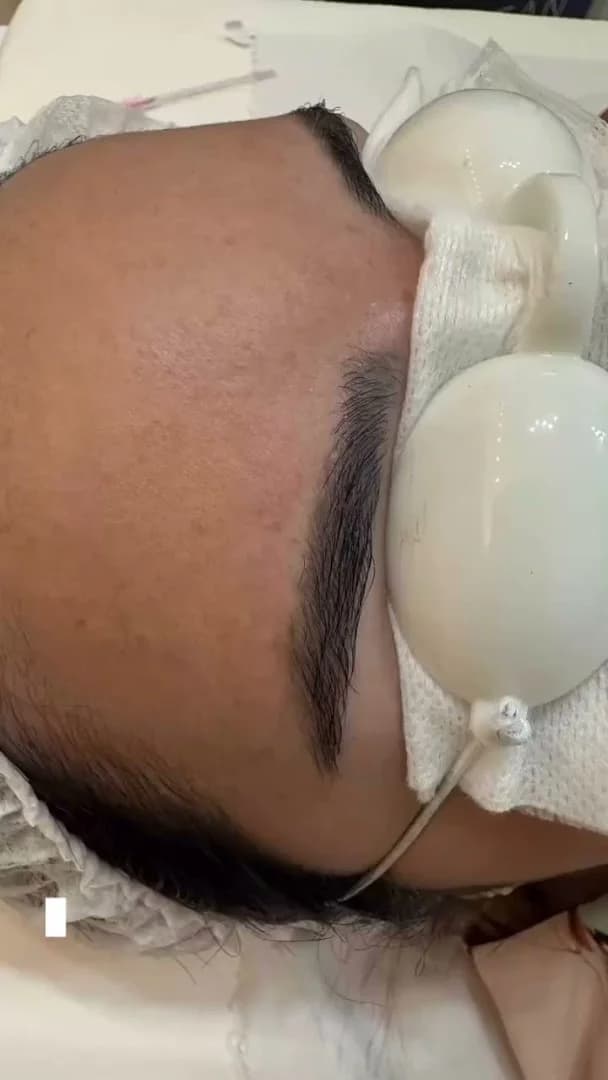 Centro de Estética e Beleza| Depilação à Laser| Remoção de Tatuagens e Micropigmentação – foto 2