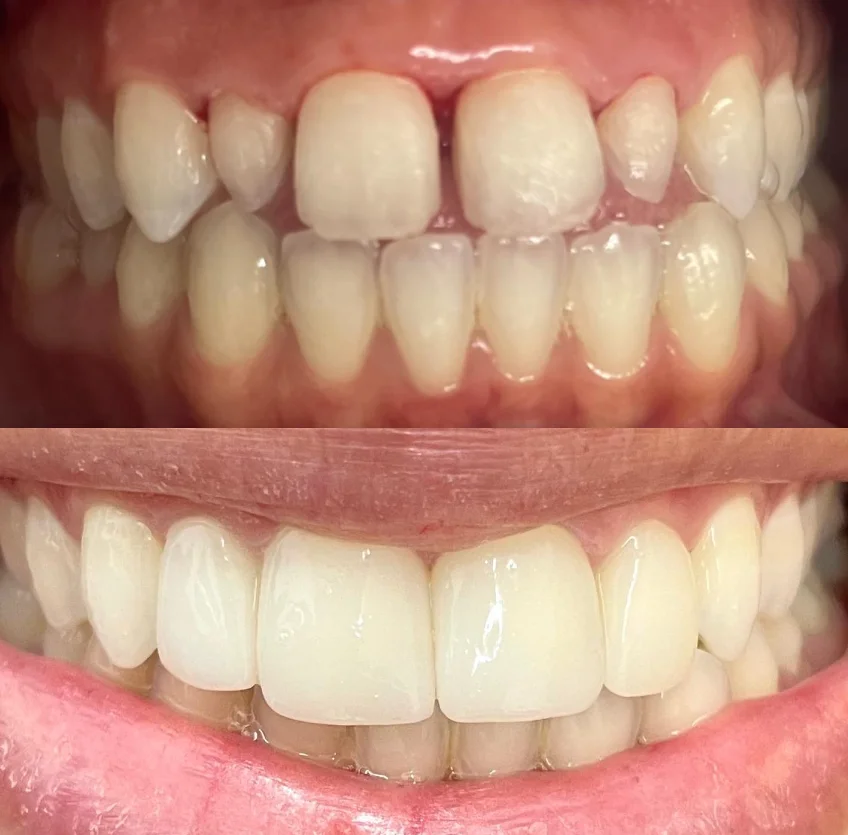 DRA.EMILIA CRISTINA/ PROFESSORA ESPECIALISTA EM HARMONIZAÇÃO FACIAL E ODONTOLOGIA SÃO PAULO