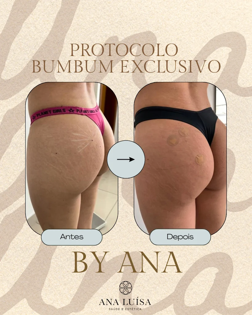Ana Luisa | Saúde e Estética Avançada | Betim