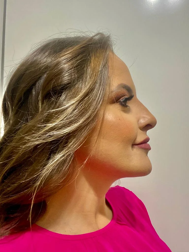 Dra. Monique Aguilera - Clínica Estética - Harmonização Facial