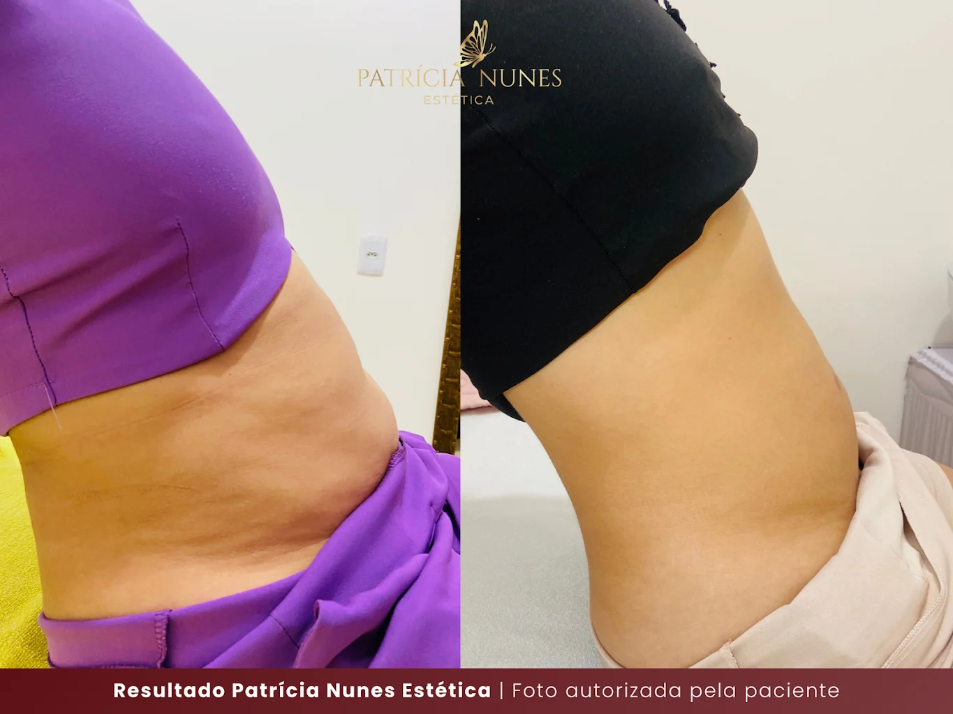 Patrícia Nunes Clínica de Estética em Trindade - Goiás | Estética Facial e Corporal