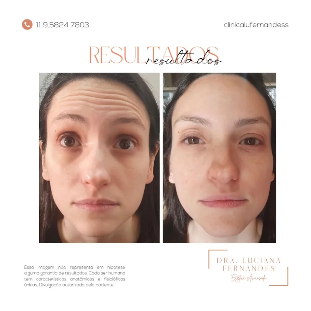 Dra.Luciana Fernandes | Botox, Preenchimento Labial e Harmonização Facial