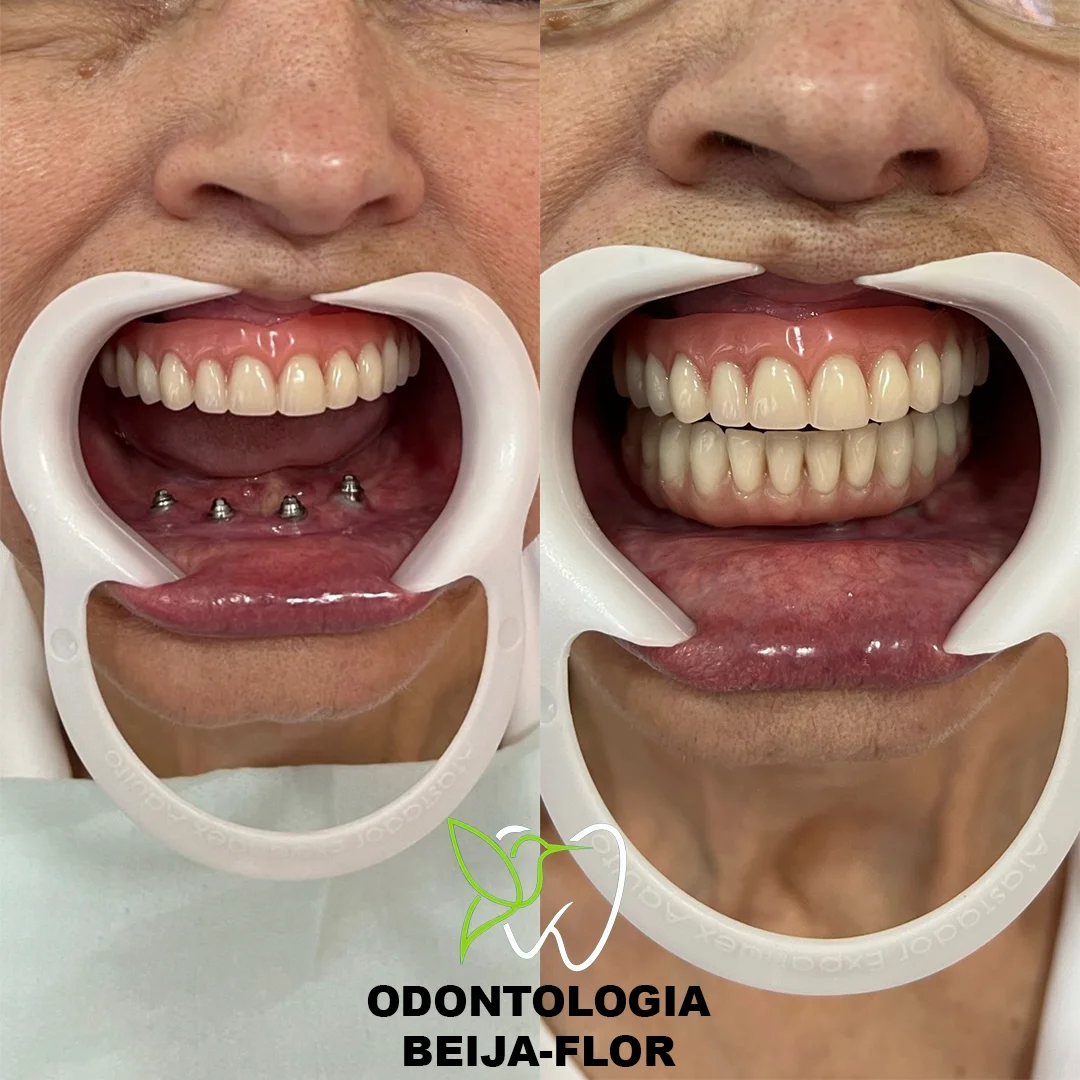Odontologia Beija-Flor Maringá