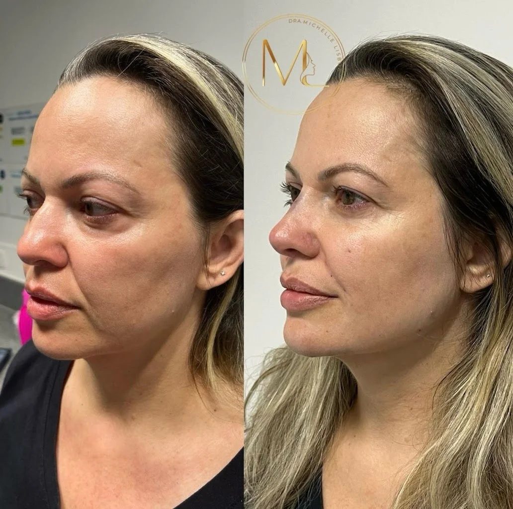 Dra. Michelle Lisboa - Harmonização Facial || Manaus