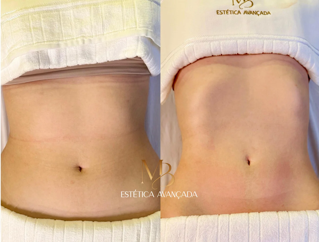 MB Estética Avançada João Pessoa | Clínica de estética em João Pessoa/PB