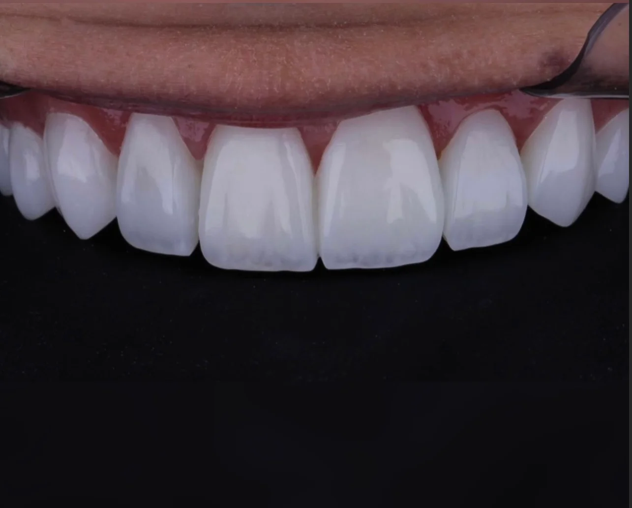 Dra Luhara Carvalho - Dentista em Cuiabá