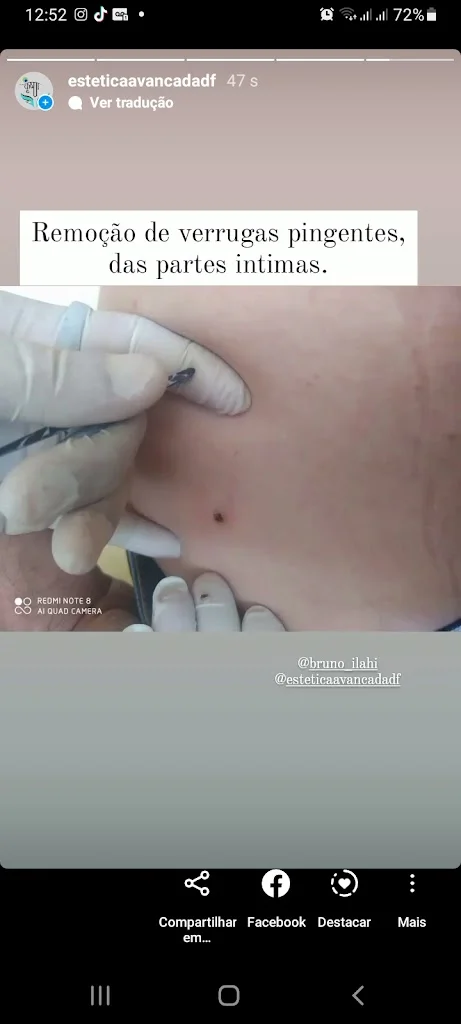 Estética avançada DF