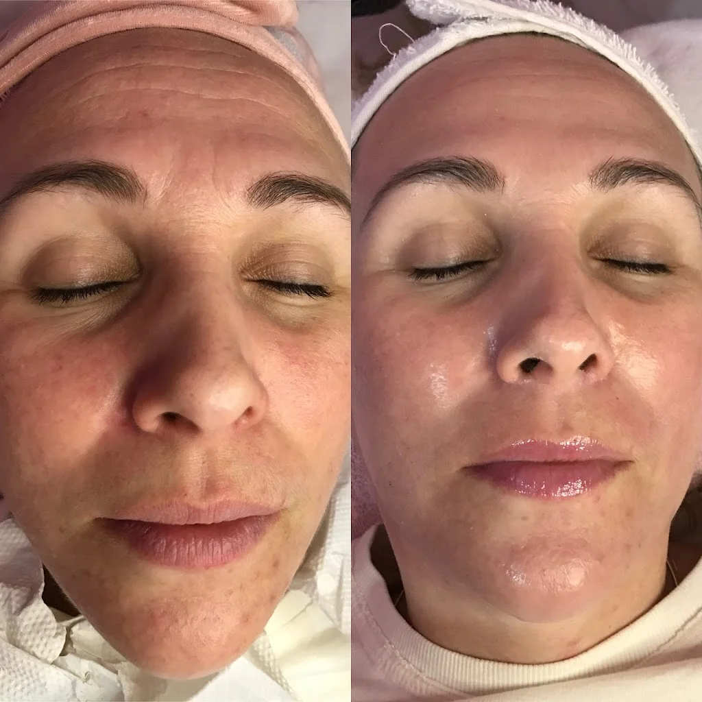 Estética avançada - Naiane Freitas