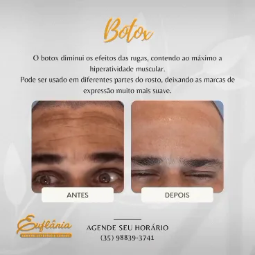 Euflânia Centro Estético e Cursos em Varginha