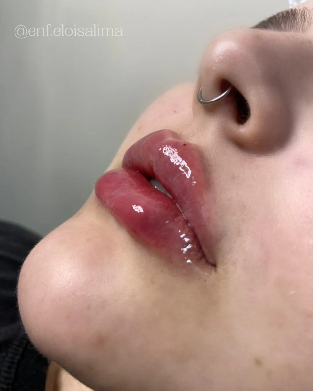 Dra. Eloisa Lima Garcia | Estética Avançada