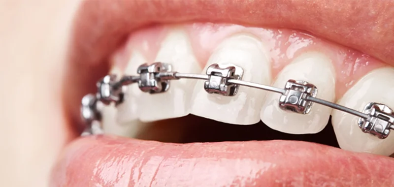 Dentista Nova Lima - Ortho 3D