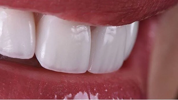 Dr. Ricardo Lippo Dentista Recife