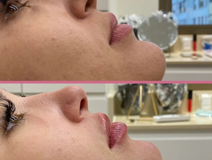 Harmonização facial e Saúde Estética - Dra Juliana Cotrin