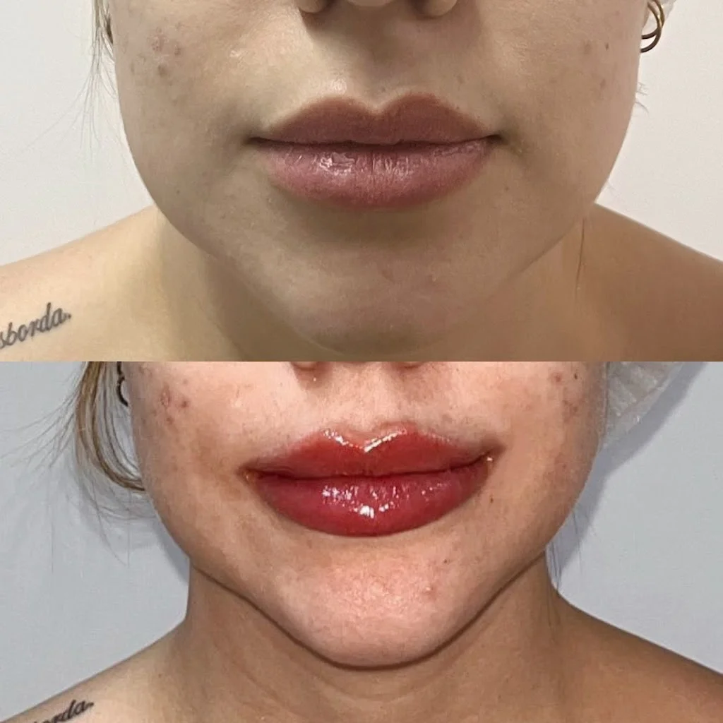Dra Dayana Ferreira - Harmonização Facial • Laser Pisom - Centro Rio de Janeiro