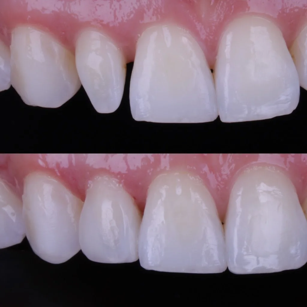 Dra. Caroline Mara - Odontologia Estética e Harmonização Facial