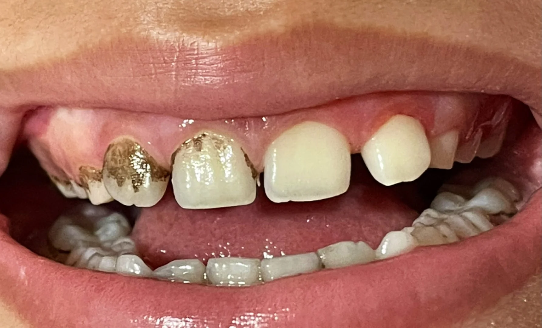Dentista Ananindeua