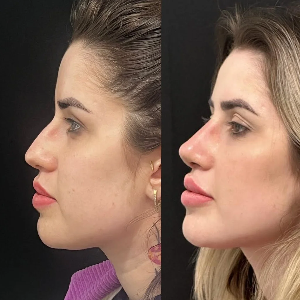 Dra. Maria Carla - Harmonização Facial e Corporal