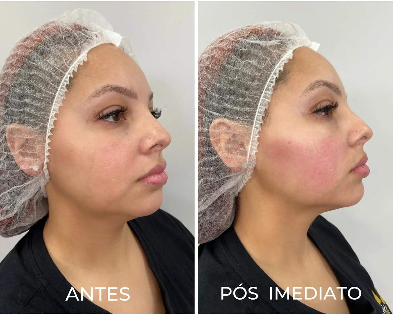 Royal Face Clínica de Estética - Palhoça