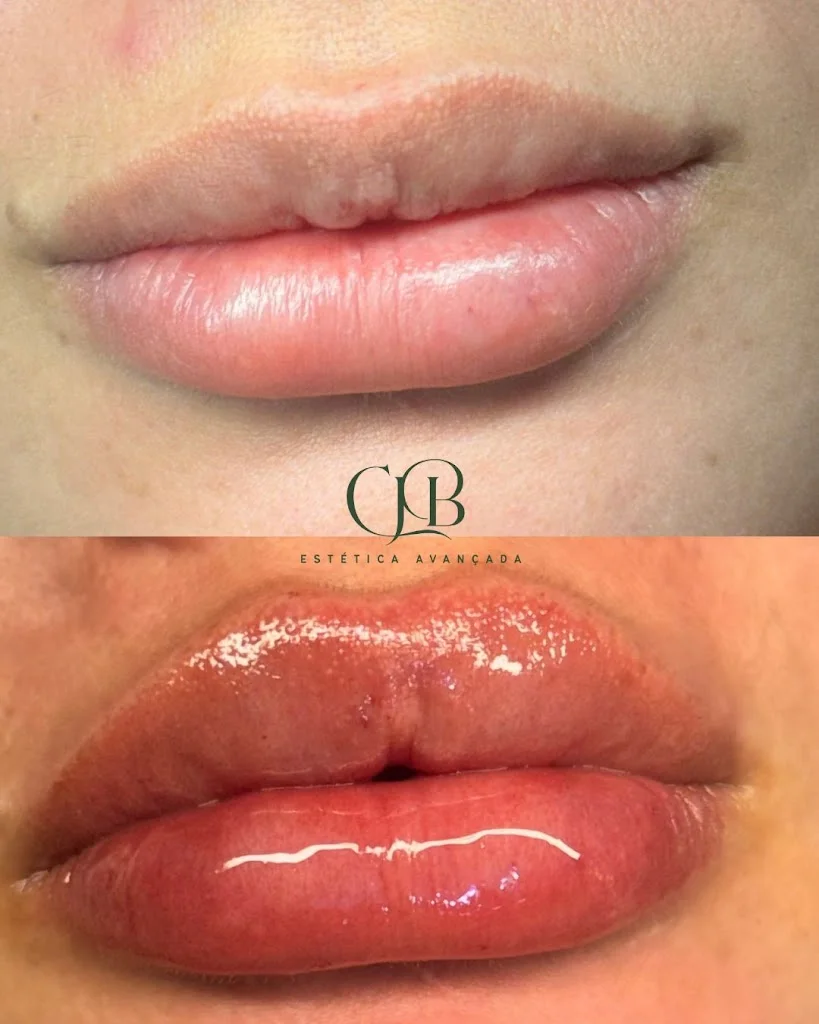 CJB ESTÉTICA AVANÇADA
