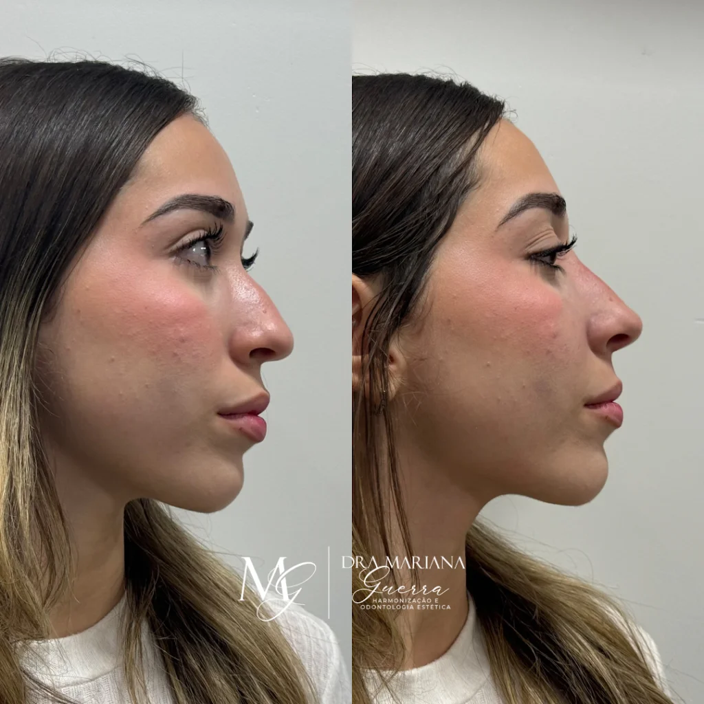 Dra. Mariana Guerra Harmonização Facial em Fortaleza