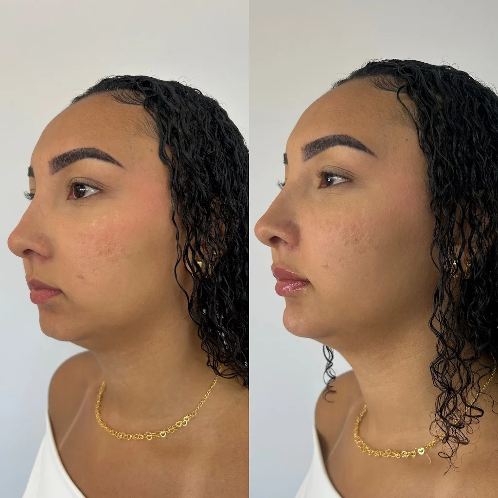 Dra.Mariana Lacerda | Harmonização Facial