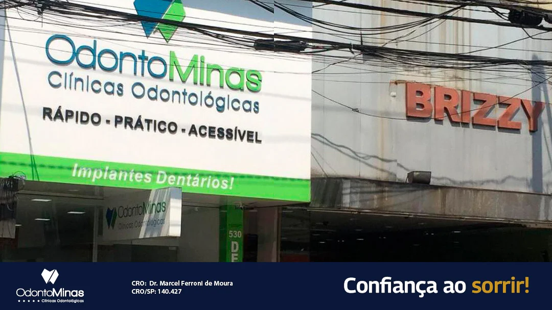 Clínica Odonto Minas I Dentista | Implante Dentário | Vila Bocaina | Mauá - SP