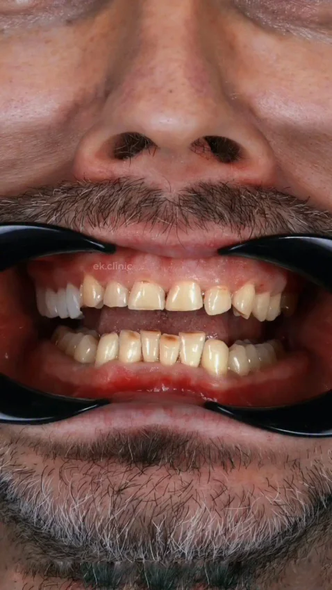 Hashtag Odontologia Especializada - Dentista Juiz de Fora - Clínica Odontologica JF
