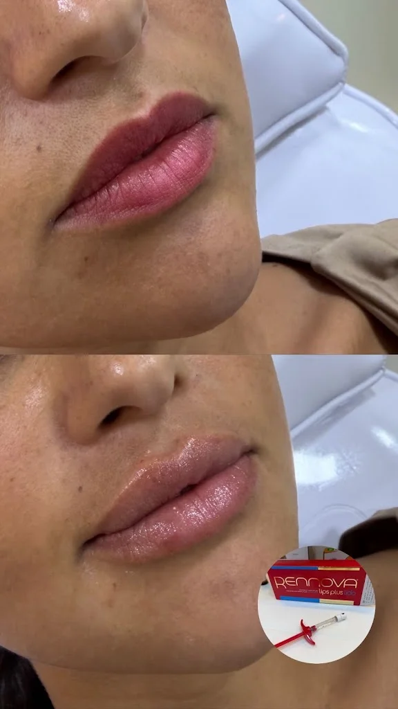 Larissa Cartaxo Estética Avançada