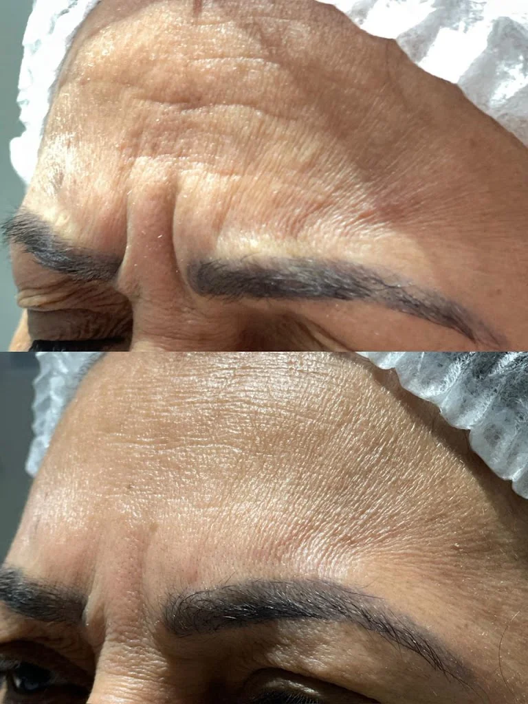 Eleve Estética Avançada | Botox, Harmonização e Laser